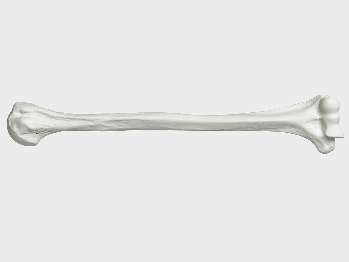 Bone left