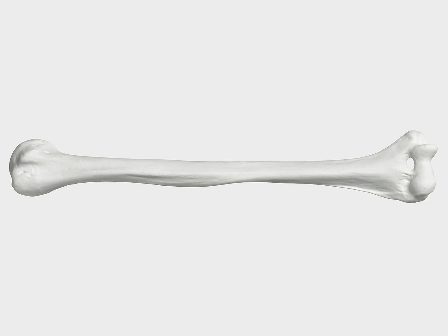 Bone right