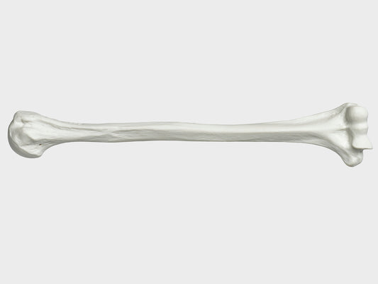 Bone left